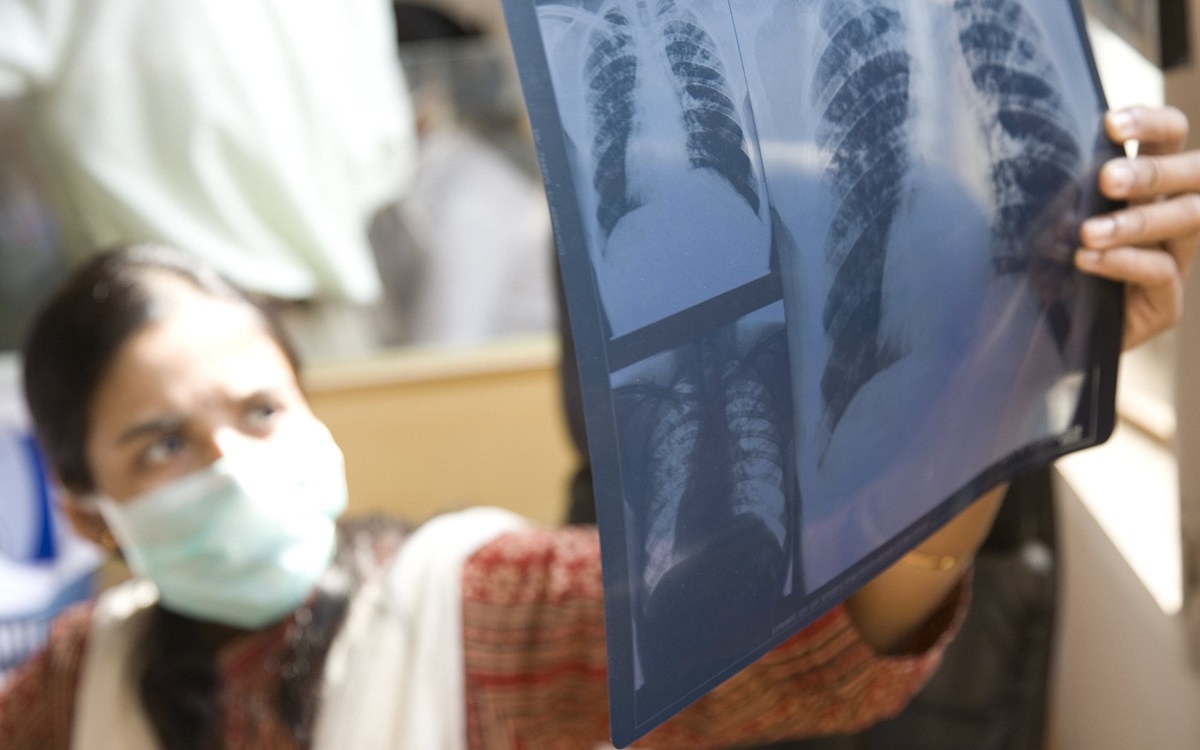 Learning from history to find success in a new TB vaccine