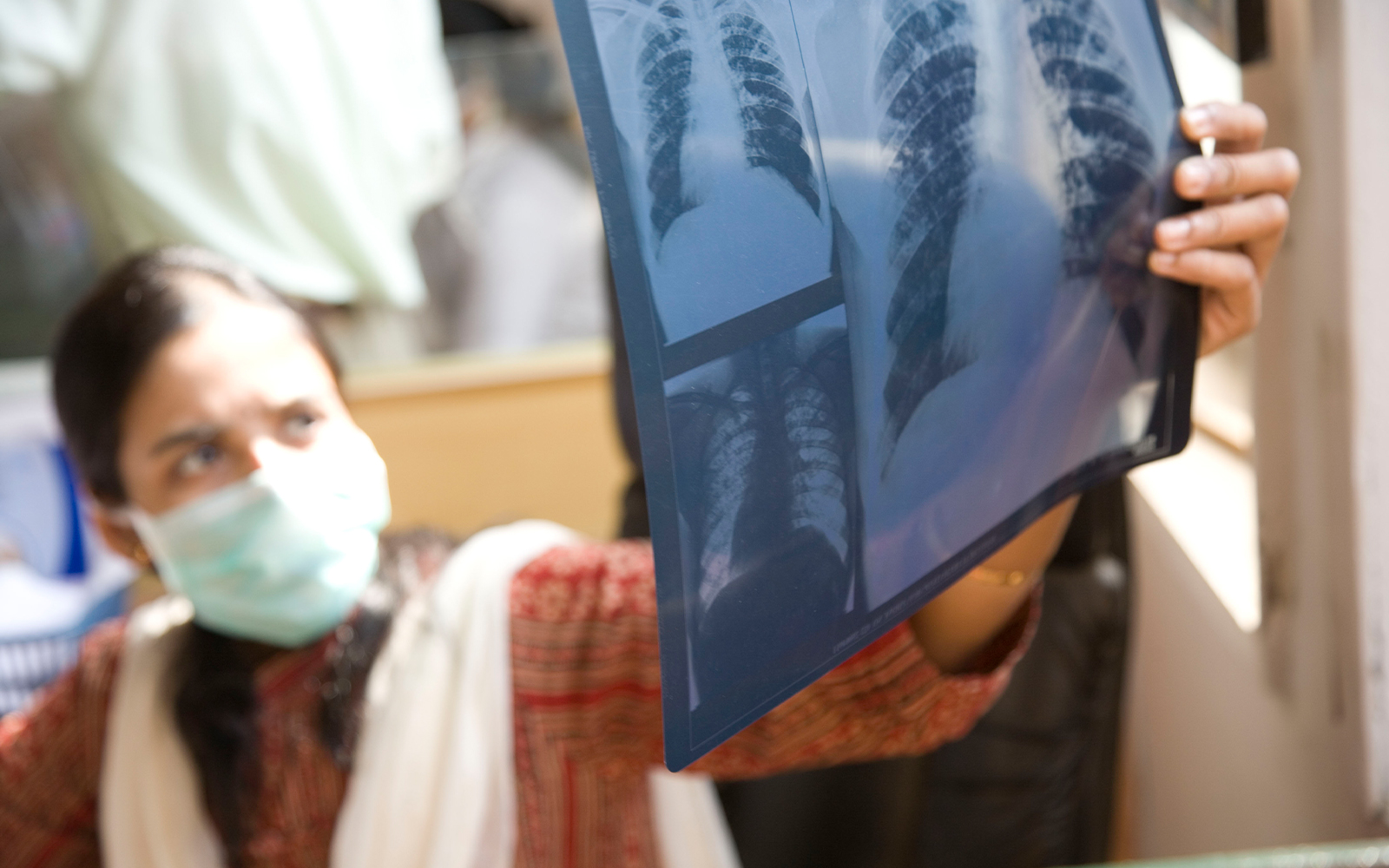 Is a Tuberculosis Vaccine Enough? Bill & Melinda Gates Foundation