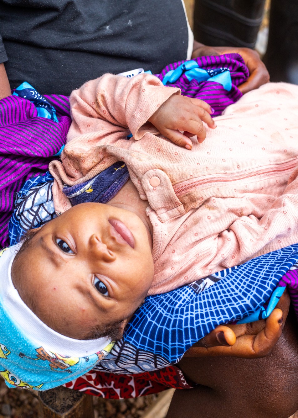 Rose sits quietly on her mother Annie Sackie’s lap after receiving the oral polio vaccine during a door-to-door immunization campaign in Bong County, Liberia, on July 30, 2025.
