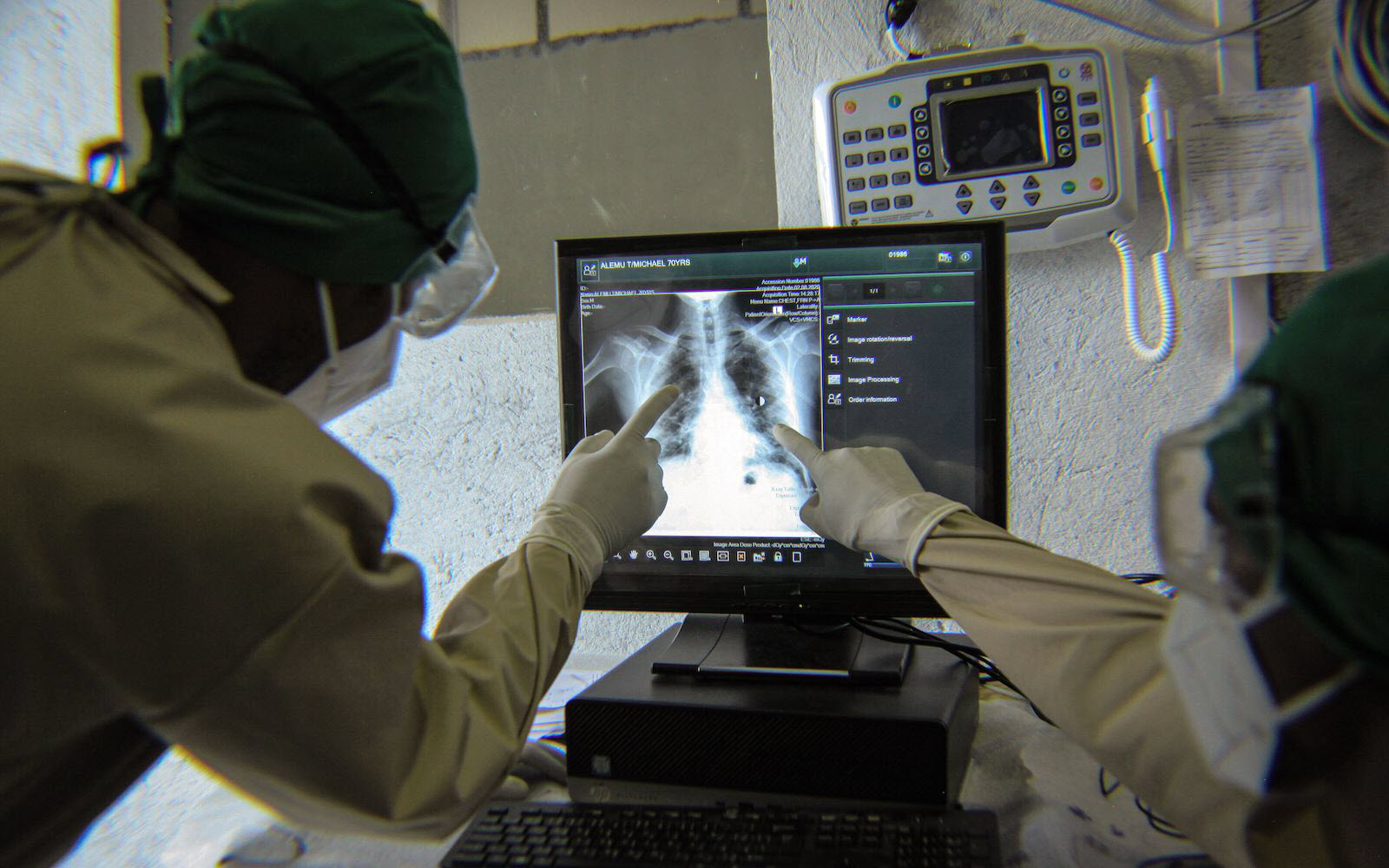 Two health workers wearing masks and goggles pointing at an x-ray on a computer monitor